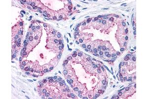 Anti-MAPK3 / ERK1 antibody IHC of human prostate. (ERK1 antibody  (Internal Region))
