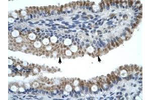 ZNF683 antibody was used for immunohistochemistry at a concentration of 4-8 ug/ml to stain Epithelial cells of intestinal villus {arrows) in Human Intestine.