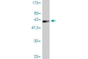 Western Blot detection against Immunogen (54. (PSMB4 antibody  (AA 1-264))