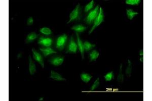 Immunofluorescence of monoclonal antibody to NME2 on HeLa cell. (NME2 antibody  (AA 51-152))