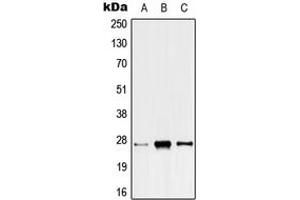 Western blot analysis of ANP32C expression in HeLa (A), SP2/0 (B), H9C2 (C) whole cell lysates.