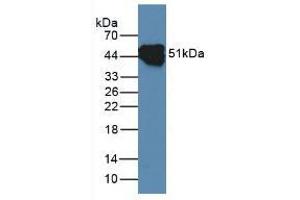 Figure. (KRT14 antibody  (AA 111-418))