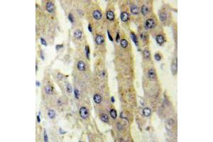 Immunohistochemical analysis of ACAD10 staining in human liver formalin fixed paraffin embedded tissue section.