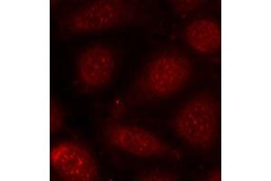 Immunofluorescence staining of methanol-fixed MCF-7 cells using Phospho-PRKCB-T641 antibody (ABIN2987563). (PKC beta antibody  (pThr641))