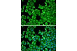 Immunofluorescence analysis of MCF-7 cell using RRM1 antibody. (RRM1 antibody)