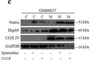 Western Blotting (WB) image for anti-Parkinson Protein 2, E3 Ubiquitin Protein Ligase (Parkin) (PARK2) (AA 1-300) antibody (ABIN3021179)