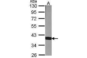 Western Blotting (WB) image for anti-Peptidylprolyl Isomerase D (PPID) antibody (ABIN2855754)