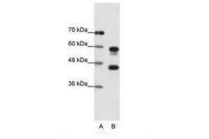 Image no. 1 for anti-Proteasome (Prosome, Macropain) 26S Subunit, ATPase, 5 (PSMC5) (C-Term) antibody (ABIN202447) (PSMC5 antibody  (C-Term))
