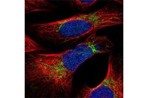 Immunofluorescent staining of human cell line U-2 OS shows positivity in mitochondria. (MRPS26 antibody)