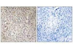 Immunohistochemistry analysis of paraffin-embedded human ovary tissue using GCNT7 antibody. (GCNT7 antibody)