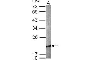 WB Image Sample (50 ug of whole cell lysate) A: mouse brain 12% SDS PAGE antibody diluted at 1:1000 (Cofilin 2 antibody)
