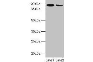 Western blot All lanes: ATP2A2 antibody at 6 μg/mL Lane 1: Mouse heart tissue Lane 2: Mouse skeletal muscle tissue Secondary Goat polyclonal to rabbit IgG at 1/10000 dilution Predicted band size: 115, 110, 112 kDa Observed band size: 115 kDa (ATP2A2 antibody  (AA 314-756))