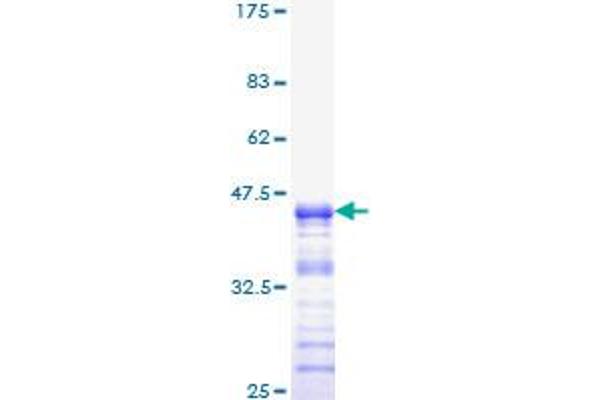 Neurofibromin 1 Protein (NF1) (AA 2719-2818) (GST tag)