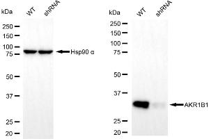 Western blotting analysis using AKR1B1 antibody (ABIN7797570).