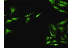 Immunofluorescence of purified MaxPab antibody to CDC25A on HeLa cell. (CDC25A antibody  (AA 1-524))