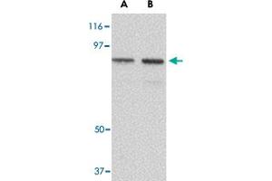 Western blot analysis of NUP107 in A-549 cell lysate with NUP107 polyclonal antibody  at (A) 1 and (B) 2 ug/mL . (NUP107 antibody  (C-Term))