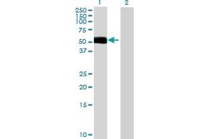 Lane 1: BMPR1B transfected lysate ( 55.