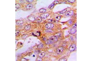 Immunohistochemistry (IHC) image for anti-Caspase 9, Apoptosis-Related Cysteine Peptidase (CASP9) (Center) antibody (ABIN7295126)