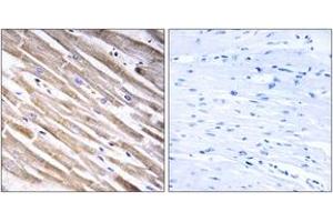 Immunohistochemistry analysis of paraffin-embedded human heart tissue, using RPL3L Antibody. (RPL3L antibody  (AA 211-260))