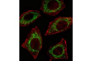 Fluorescent confocal image of A549 cell stained with ALDH2 Antibody (N-term). (ALDH2 antibody  (N-Term))