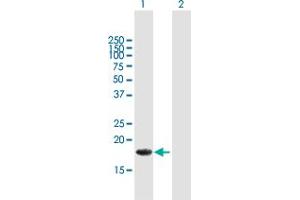 Western Blot analysis of ALG13 expression in transfected 293T cell line by ALG13 MaxPab polyclonal antibody. (ALG13 antibody  (AA 1-165))