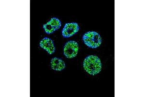 Confocal immunofluorescent analysis of WDR42C Antibody (N-term) (ABIN655843 and ABIN2845256) with ZR-75-1 cell followed by Alexa Fluor 488-conjugated goat anti-rabbit lgG (green). (DCAF8L2 antibody  (N-Term))