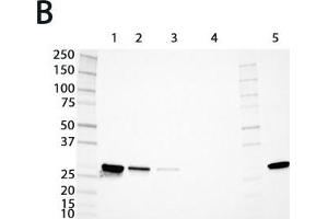 Expression analysis of rat GSTs of the mu and alpha classes. (GSTM4 antibody  (AA 21-215))