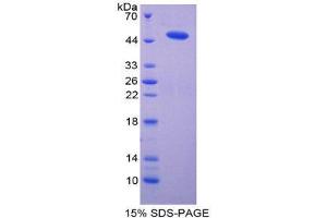 SDS-PAGE (SDS) image for Microsomal Glutathione S-Transferase 1 (MGST1) (AA 8-155) protein (His tag,GST tag) (ABIN2123277)