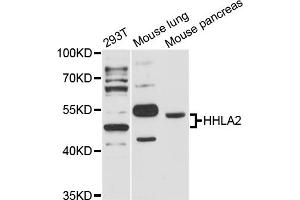 Western blot analysis of extracts of various cell lines, using HHLA2 antibody (ABIN6293271) at 1:3000 dilution.