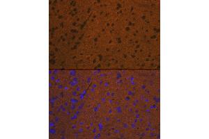 Immunofluorescence (IF) image for anti-Syntaxin 1B (STX1B) antibody (ABIN7270685)