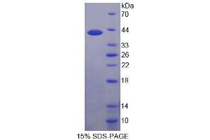SDS-PAGE (SDS) image for Pim-3 Oncogene (PIM3) (AA 1-326) protein (His tag) (ABIN4991021) (PIM3 Protein (AA 1-326) (His tag))