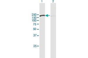 Western Blot analysis of SMC3 expression in transfected 293T cell line by SMC3 MaxPab polyclonal antibody. (SMC3 antibody  (AA 1-1217))