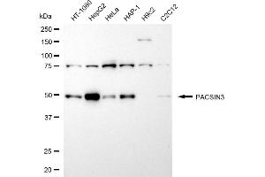 anti-Protein Kinase C and Casein Kinase Substrate in Neurons 3 (PACSIN3) antibody