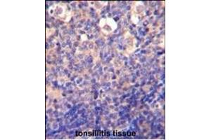 KLRC2 Antibody (N-term) (ABIN652570 and ABIN2842383) immunohistochemistry analysis in formalin fixed and paraffin embedded human tonsillitis tissue followed by peroxidase conjugation of the secondary antibody and DAB staining. (KLRC2 antibody  (N-Term))