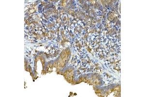 Immunohistochemistry (IHC) image for anti-Interferon Induced with Helicase C Domain 1 (IFIH1) (AA 1-205) antibody (ABIN6142174)