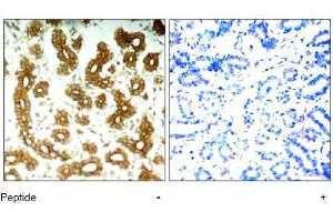 Image no. 1 for anti-Keratin 8 (KRT8) (Ser73) antibody (ABIN197582)