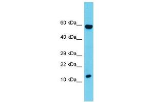 Host: Rabbit  Target Name: Cd247  Sample Tissue: Rat Thymus lysates  Antibody Dilution: 1. (CD247 antibody  (C-Term))