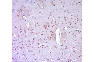 Immunohistochemistry (Paraffin-embedded Sections) (IHC (p)) image for anti-Poly (ADP-Ribose) Polymerase 1 (PARP1) (AA 201-300) antibody (ABIN677903)