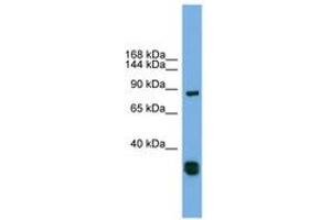 Image no. 1 for anti-Follistatin-Like 5 (FSTL5) (C-Term) antibody (ABIN6744178) (FSTL5 antibody  (C-Term))