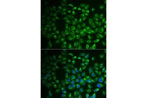 Immunofluorescence analysis of A549 cell using FABP6 antibody.