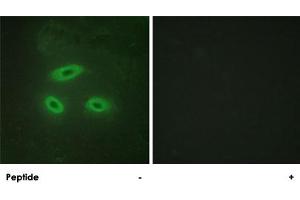 Immunofluorescence analysis of HeLa cells, using NKTR polyclonal antibody .