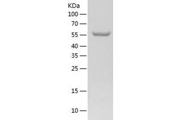 NAE1 Protein (AA 1-534) (His tag)