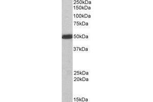 Image no. 2 for anti-C-Src tyrosine Kinase (CSK) (C-Term) antibody (ABIN374096)