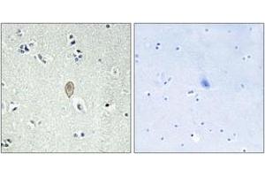 Immunohistochemistry analysis of paraffin-embedded human brain tissue, using FZD5 Antibody. (FZD5 antibody  (AA 31-80))