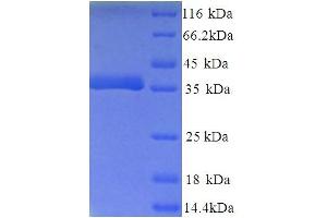 SDS-PAGE (SDS) image for Chromosome 18 Open Reading Frame 10 (C18orf10) (AA 35-354) protein (His tag) (ABIN5713398)