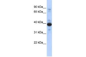 WB Suggested Anti-RNF34 Antibody Titration:  0. (RNF34 antibody  (Middle Region))