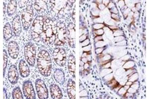 Immunohistochemical staining (Formalin-fixed paraffin-embedded sections) analysis of human small intestine with ECM1 monoclonal antibody, clone SC05  at 1:500 using peroxidase-conjugate and DAB chromogen (Note: cytoplasmic and membrane staining). (ECM1 antibody)