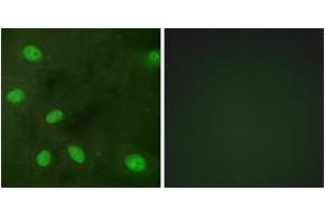 Immunofluorescence analysis of HeLa cells, using GIRK1/KIR3. (KCNJ3 antibody  (pSer185))