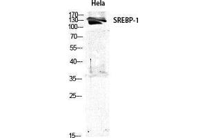 Western Blotting (WB) image for anti-Sterol Regulatory Element Binding Transcription Factor 1 (SREBF1) (Tyr1175) antibody (ABIN3177512) (SREBF1 antibody  (Tyr1175))
