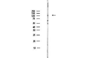 anti-phosphodiesterase 5A, cGMP-Specific (PDE5A) (C-Term) antibody